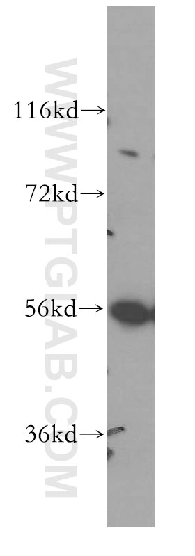 Western Blot (WB) analysis of Jurkat cells using LCK Polyclonal antibody (12477-1-AP)
