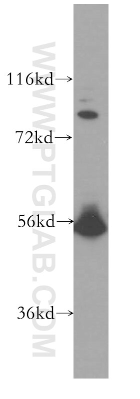 Western Blot (WB) analysis of Jurkat cells using LCK Polyclonal antibody (12477-1-AP)