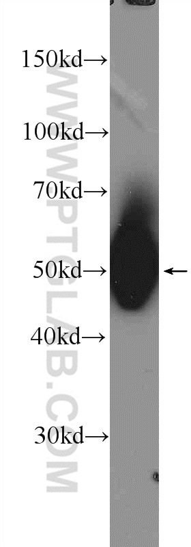 Western Blot (WB) analysis of Jurkat cells using LCK Polyclonal antibody (24497-1-AP)