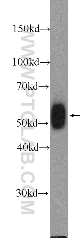 Western Blot (WB) analysis of mouse thymus tissue using LCK Polyclonal antibody (24497-1-AP)