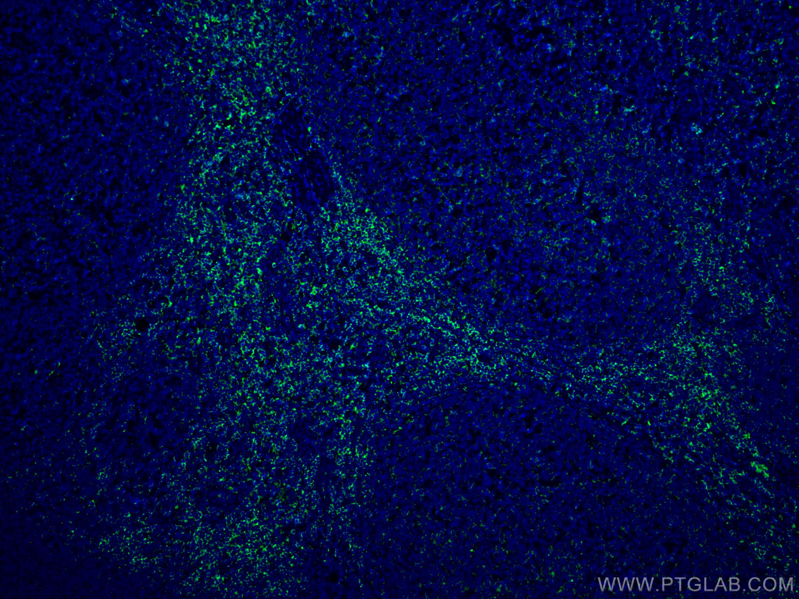 Immunofluorescence (IF) / fluorescent staining of human tonsillitis tissue using LCK Monoclonal antibody (60162-1-Ig)