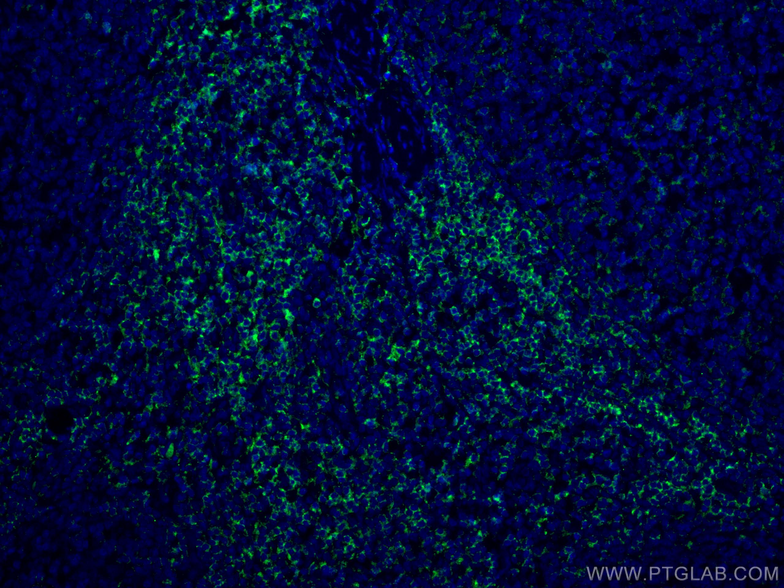 Immunofluorescence (IF) / fluorescent staining of human tonsillitis tissue using LCK Monoclonal antibody (60162-1-Ig)