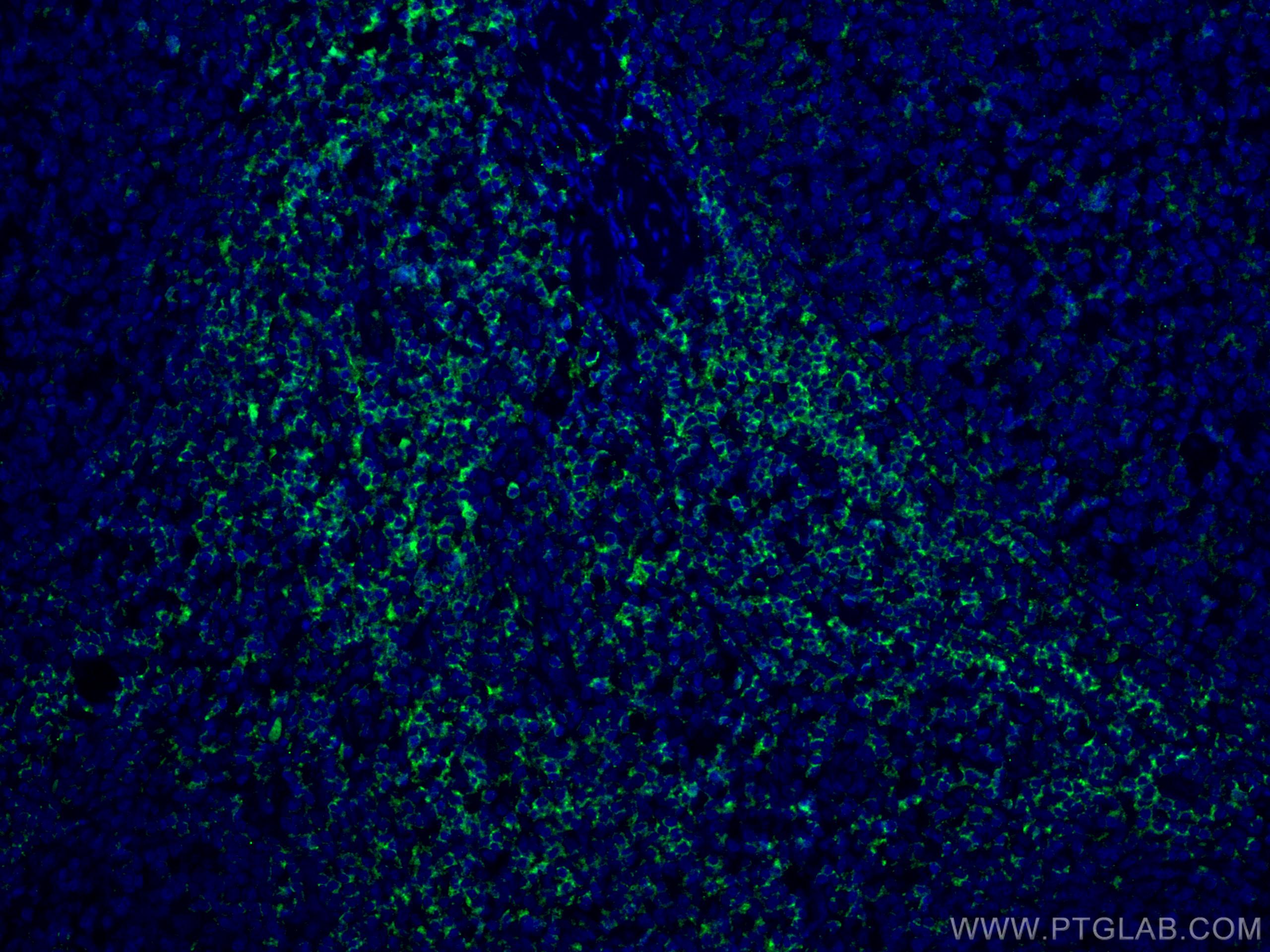 IF Staining of human tonsillitis using 60162-1-Ig