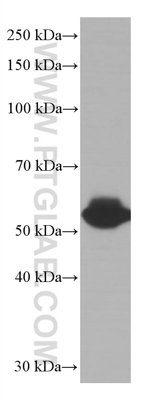 Western Blot (WB) analysis of Jurkat cells using LCK Monoclonal antibody (60162-1-Ig)