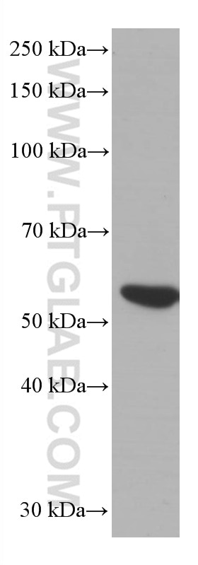 Western Blot (WB) analysis of pig thymus tissue using LCK Monoclonal antibody (60162-1-Ig)