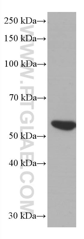 WB analysis of pig thymus using 60162-1-Ig