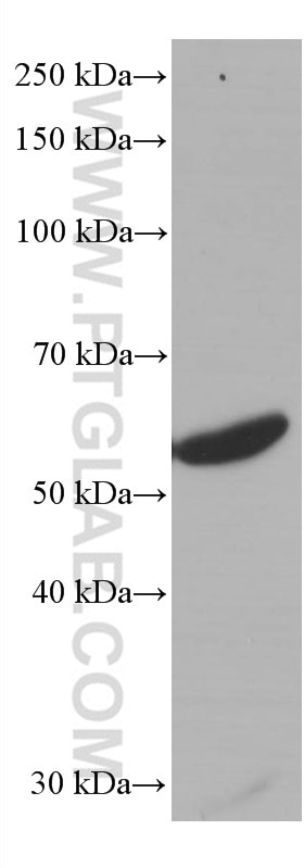 Western Blot (WB) analysis of rat thymus tissue using LCK Monoclonal antibody (60162-1-Ig)