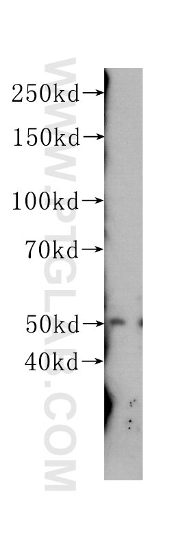 WB analysis of Jurkat using 60162-2-Ig