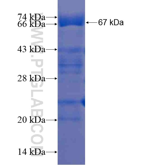 LCK fusion protein Ag21475 SDS-PAGE