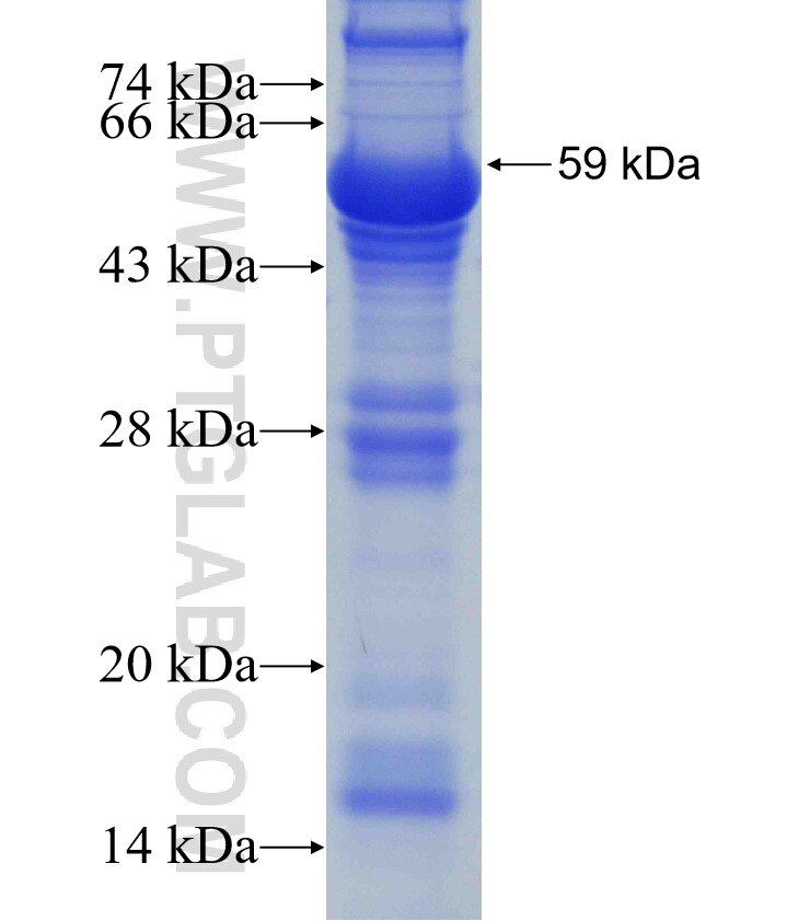 LCK fusion protein Ag3176 SDS-PAGE