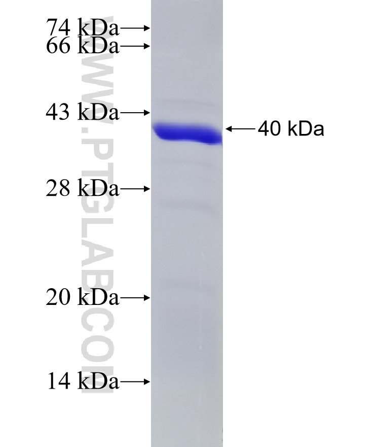 LCK fusion protein Ag7694 SDS-PAGE