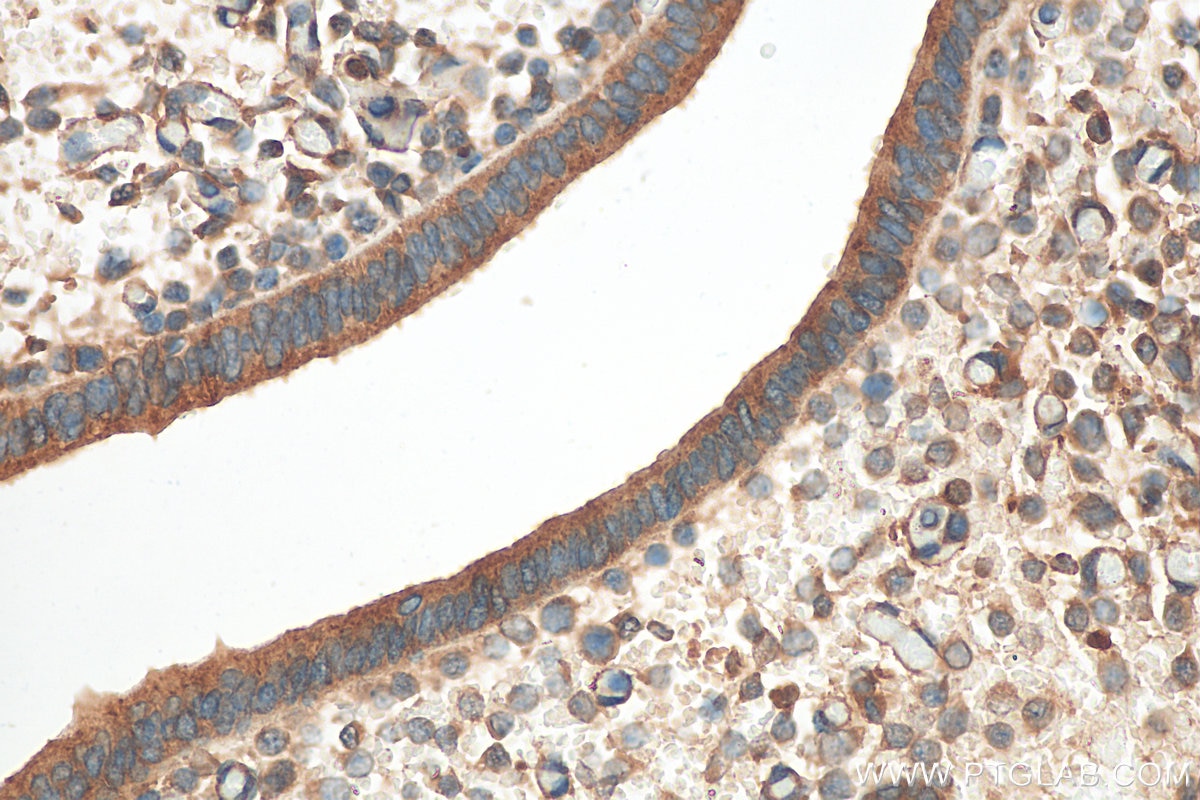 Immunohistochemistry (IHC) staining of mouse uterus tissue using LCMT1 Polyclonal antibody (30222-1-AP)