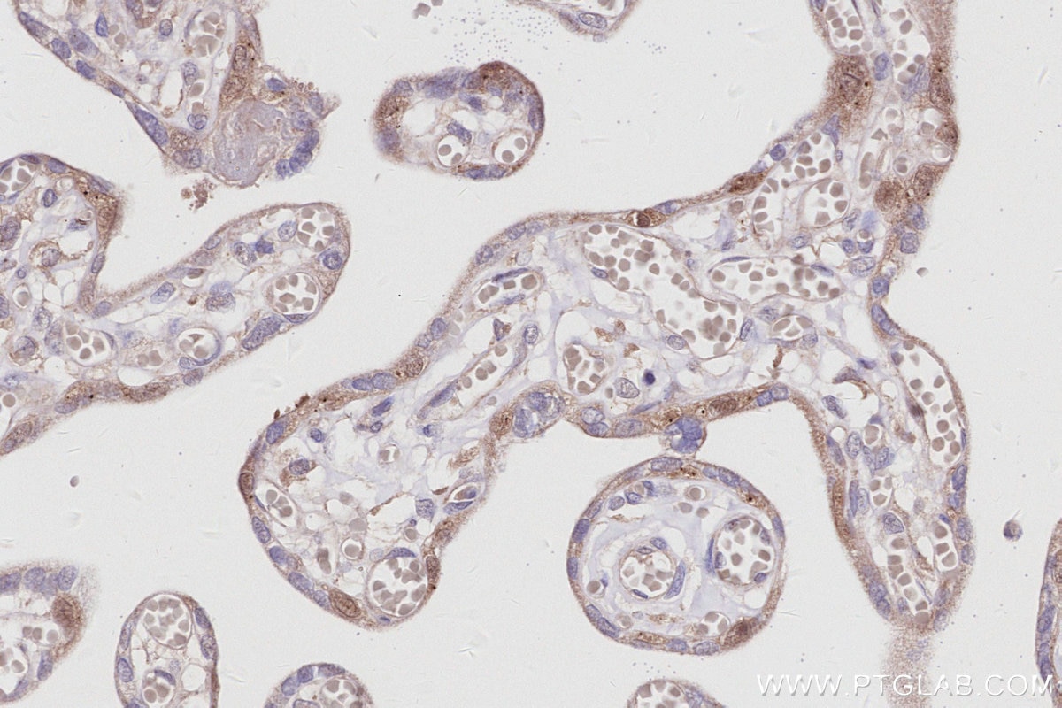 IHC staining of human placenta using 30222-1-AP Immunohistochemistry (IHC) staining of human placenta tissue using LCMT1 Polyclonal antibody (30222-1-AP)