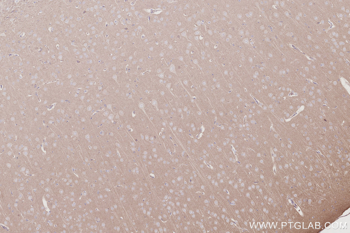 IHC staining of rat brain using 30222-1-AP Immunohistochemistry (IHC) staining of rat brain tissue using LCMT1 Polyclonal antibody (30222-1-AP)