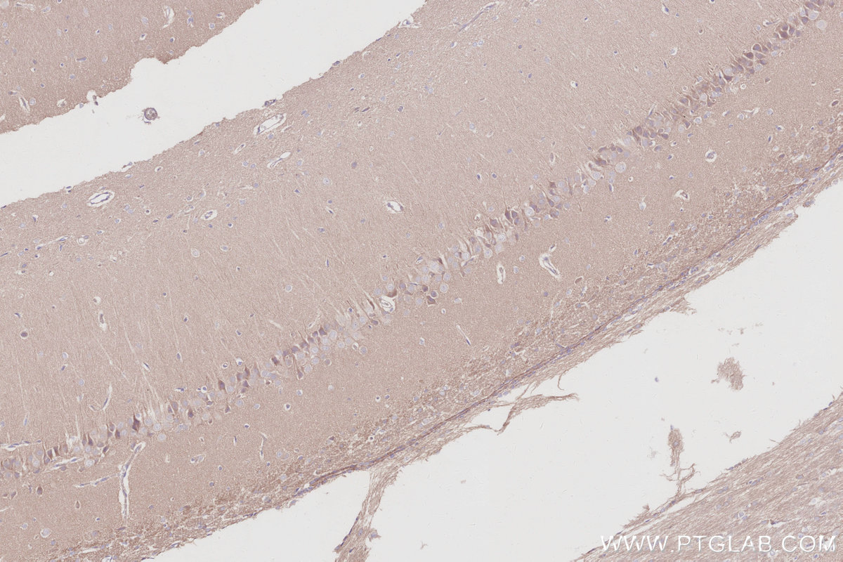 IHC staining of rat brain using 30222-1-AP Immunohistochemistry (IHC) staining of rat brain tissue using LCMT1 Polyclonal antibody (30222-1-AP)