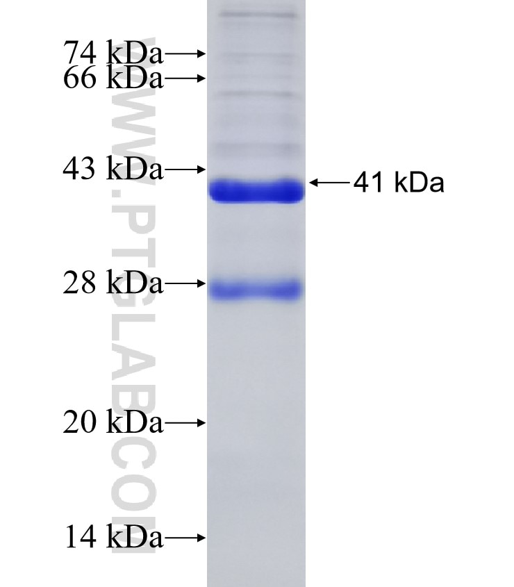LCMT1 fusion protein Ag32038 SDS-PAGE