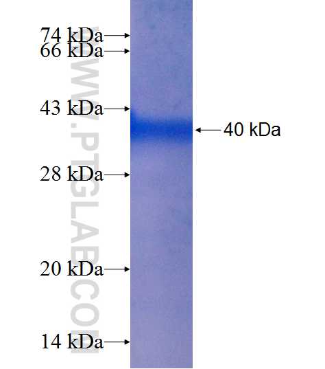 LCMT1 fusion protein Ag7510 SDS-PAGE
