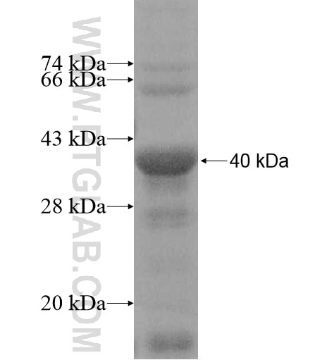 LCMT2 fusion protein Ag11145 SDS-PAGE