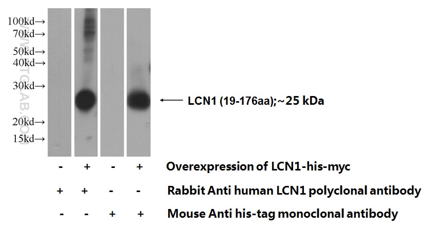 Western Blot (WB) analysis of Transfected HEK-293 cells using LCN1 Polyclonal antibody (17900-1-AP)