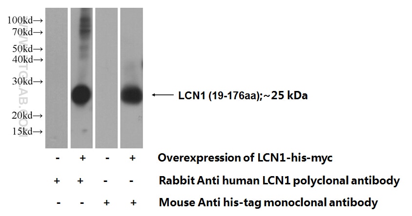 WB analysis of Transfected HEK-293 using 17900-1-AP