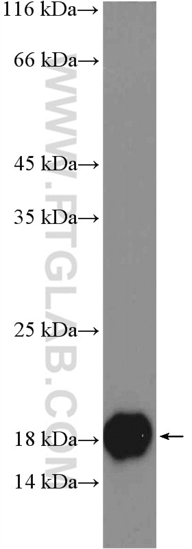 Western Blot (WB) analysis of human saliva using LCN1 Polyclonal antibody (17900-1-AP)