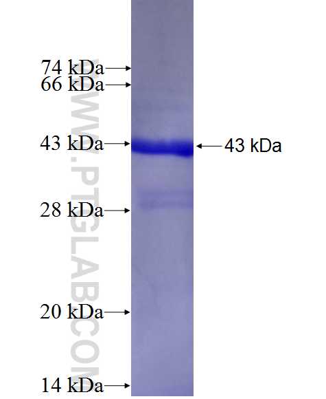 LCN12 fusion protein Ag27402 SDS-PAGE