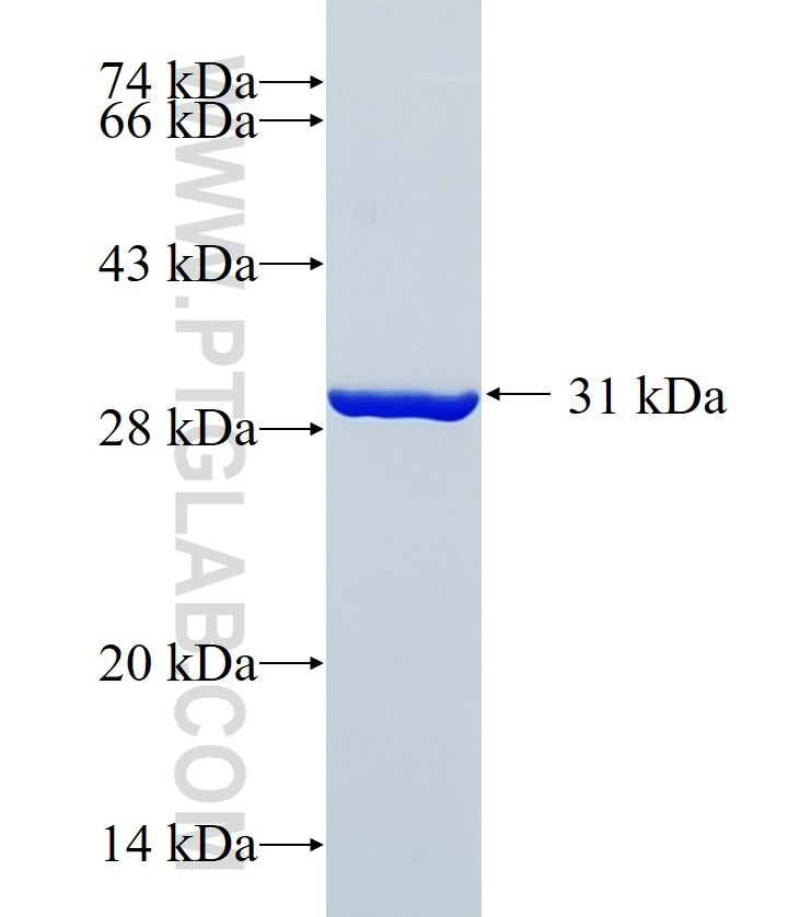 LCN12 fusion protein Ag32889 SDS-PAGE LCN12 fusion protein Ag32889 SDS-PAGE