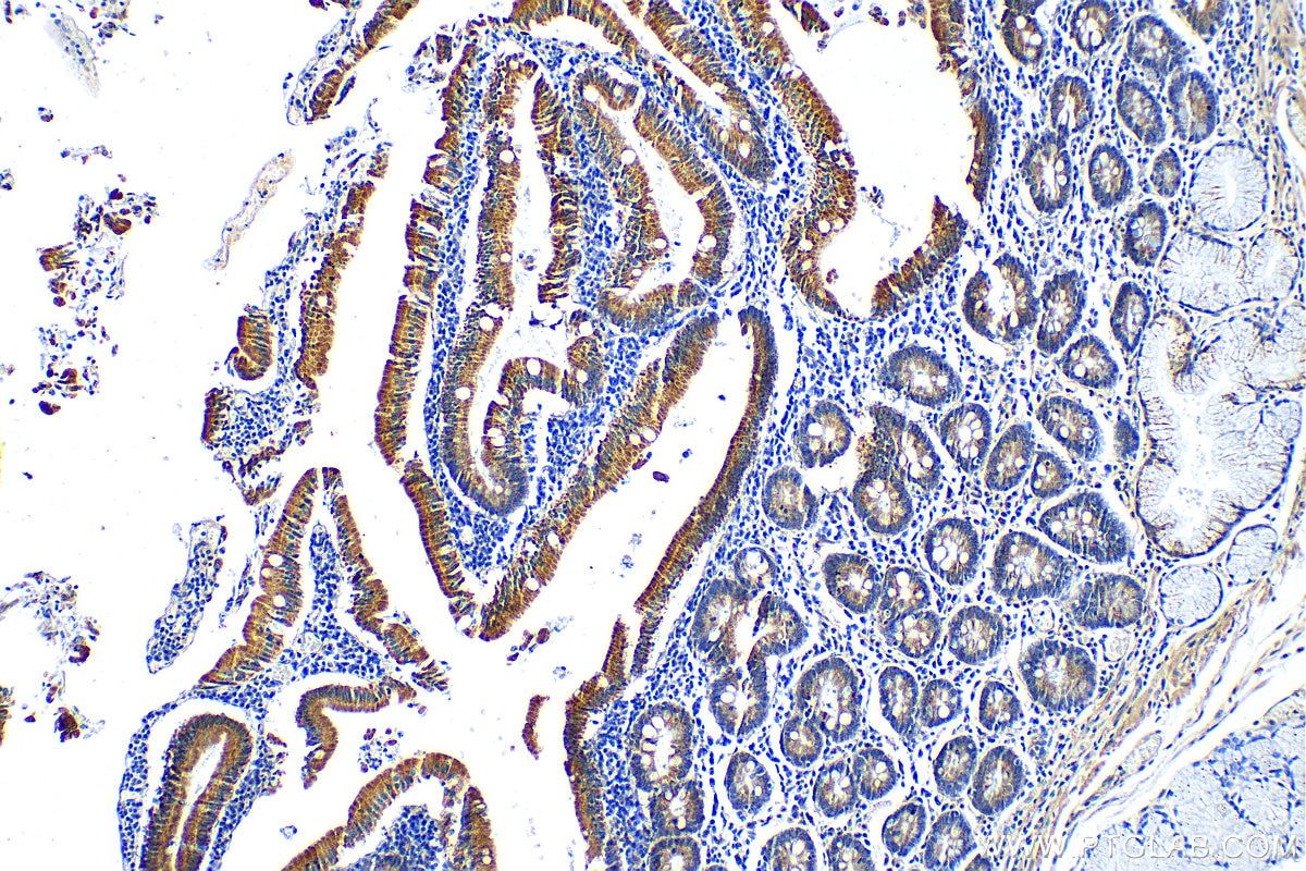 LCN15