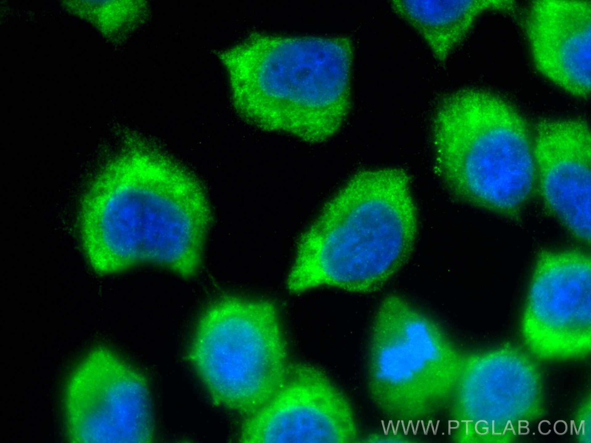 Immunofluorescence (IF) / fluorescent staining of A431 cells using LCN2 Polyclonal antibody (26991-1-AP)