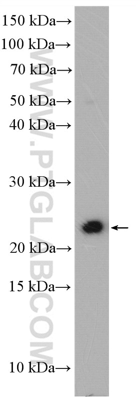 WB analysis of human saliva using 26991-1-AP