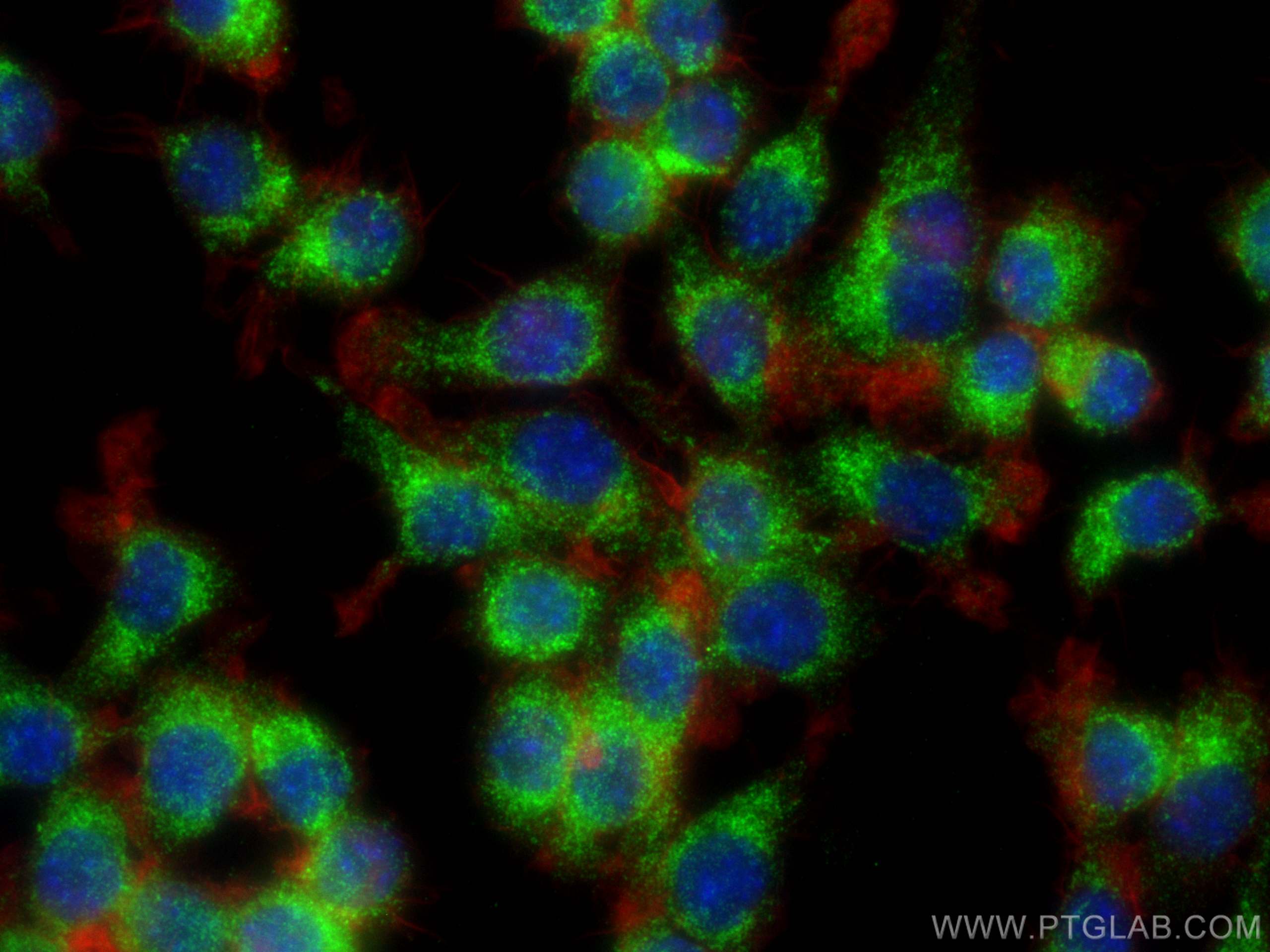 Immunofluorescence (IF) / fluorescent staining of RAW 264.7 cells using Lipocalin-2/NGAL Polyclonal antibody (30700-1-AP)