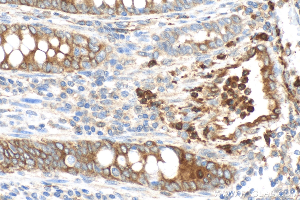 Lipocalin-2/NGAL