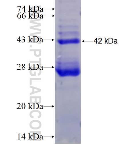 LCN2 fusion protein Ag25715 SDS-PAGE