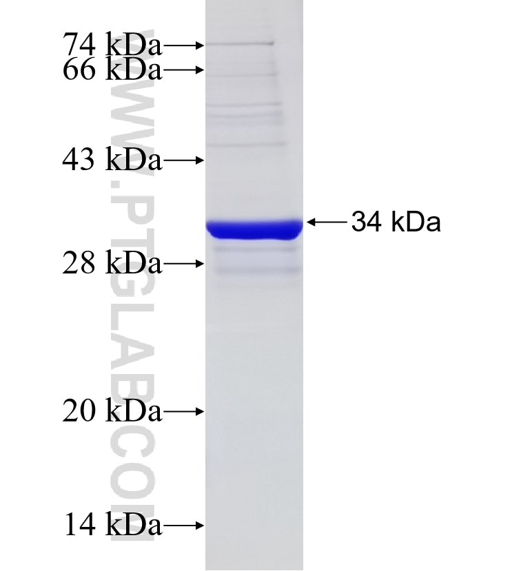 LCN2 fusion protein Ag33369 SDS-PAGE