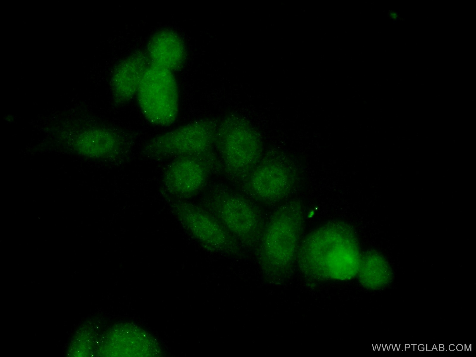 Immunofluorescence (IF) / fluorescent staining of HeLa cells using LCOR Polyclonal antibody (14476-1-AP)