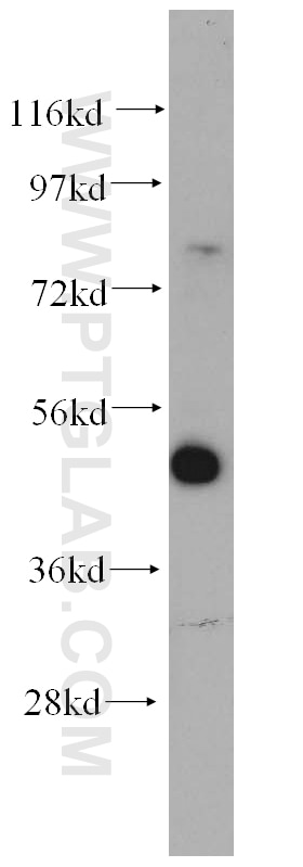 Western Blot (WB) analysis of HeLa cells using LCOR Polyclonal antibody (14476-1-AP)