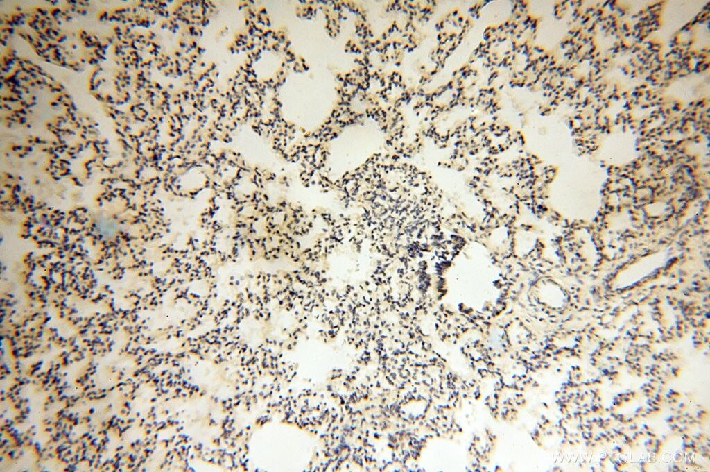IHC staining of human lung using 17468-1-AP