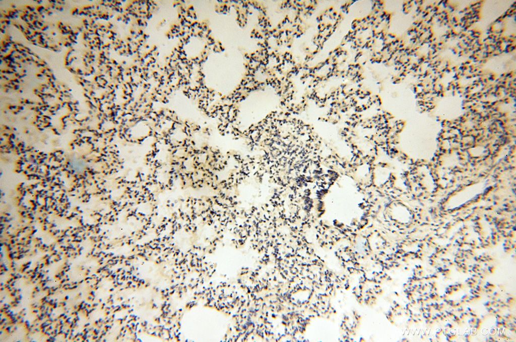 Immunohistochemistry (IHC) staining of human lung tissue using LCORL Polyclonal antibody (17468-1-AP)