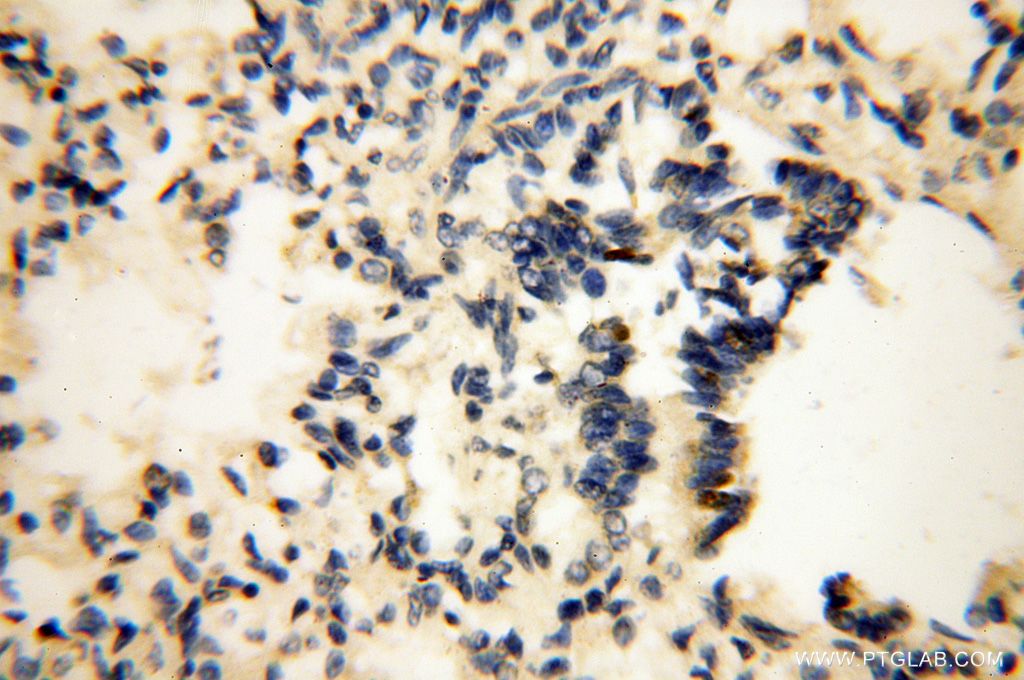 Immunohistochemistry (IHC) staining of human lung tissue using LCORL Polyclonal antibody (17468-1-AP)
