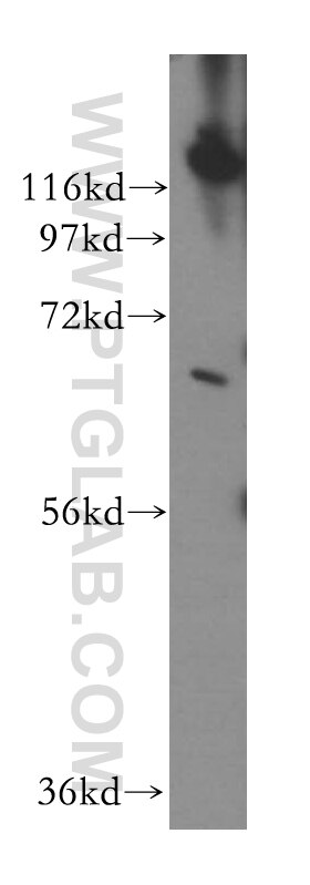 Western Blot (WB) analysis of PC-3 cells using LCORL Polyclonal antibody (17468-1-AP)