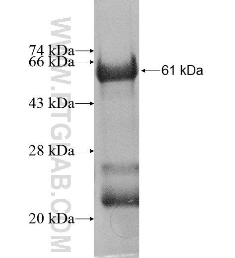 LCORL fusion protein Ag11377 SDS-PAGE
