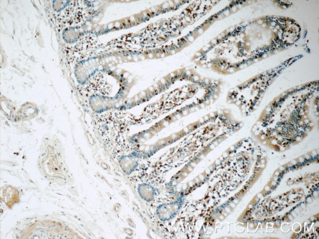 Immunohistochemistry (IHC) staining of human small intestine tissue using L-Plastin Polyclonal antibody (13025-1-AP)