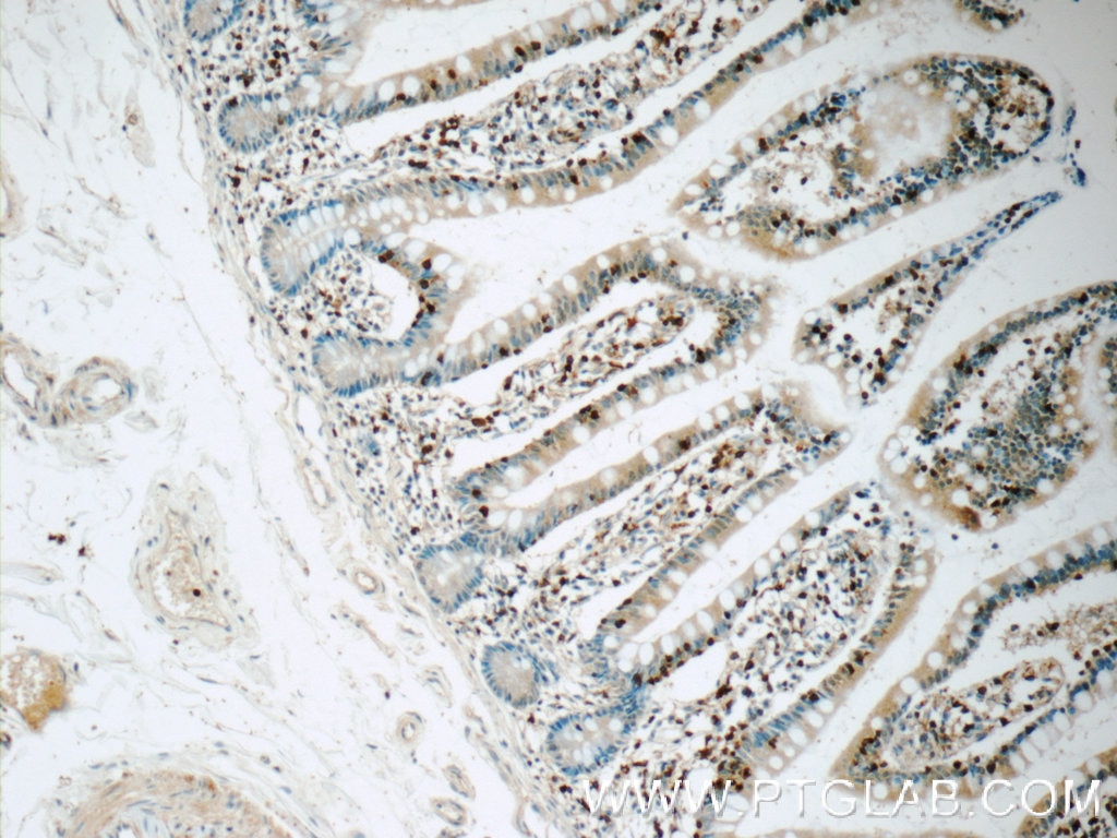 IHC staining of human small intestine using 13025-1-AP