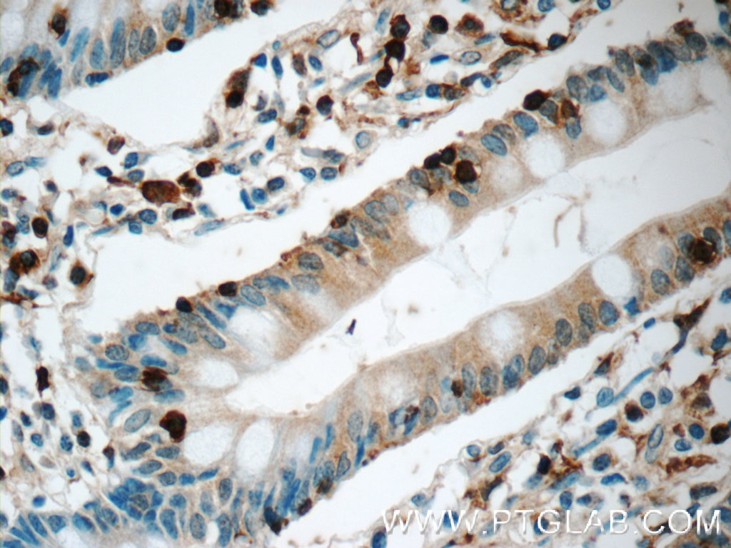 Immunohistochemistry (IHC) staining of human small intestine tissue using L-Plastin Polyclonal antibody (13025-1-AP)