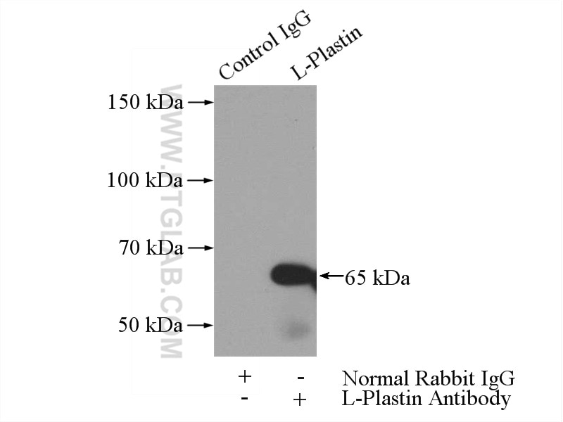 Immunoprecipitation (IP) experiment of Jurkat cells using L-Plastin Polyclonal antibody (13025-1-AP)
