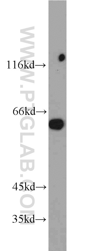 Western Blot (WB) analysis of mouse spleen tissue using L-Plastin Polyclonal antibody (13025-1-AP)