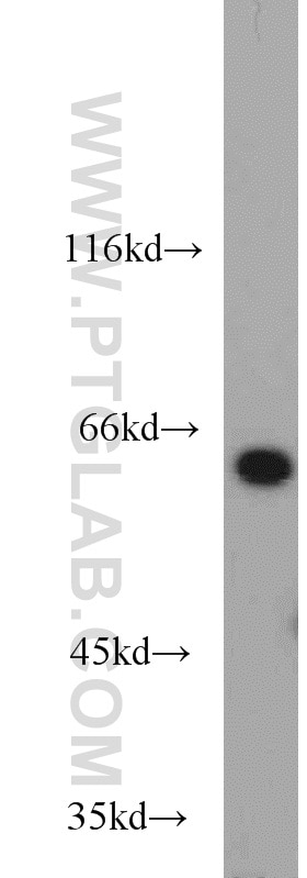 Western Blot (WB) analysis of Jurkat cells using L-Plastin Polyclonal antibody (13025-1-AP)