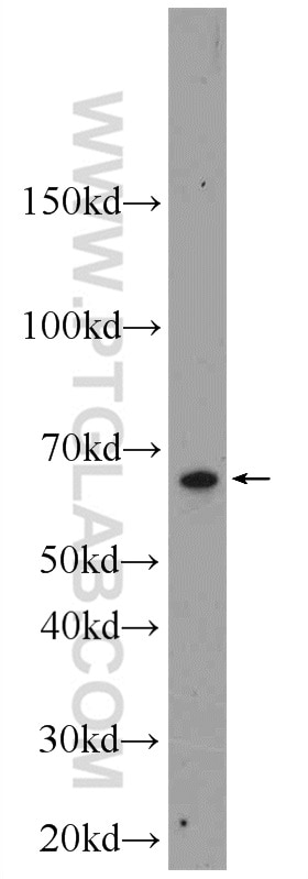 Western Blot (WB) analysis of K-562 cells using L-Plastin Polyclonal antibody (13025-1-AP)