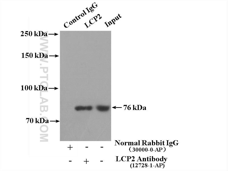 Immunoprecipitation (IP) experiment of Jurkat cells using SLP76 Polyclonal antibody (12728-1-AP)