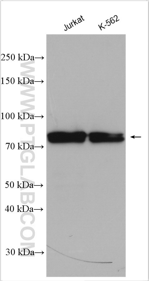 Western Blot (WB) analysis of various lysates using SLP76 Polyclonal antibody (12728-1-AP)